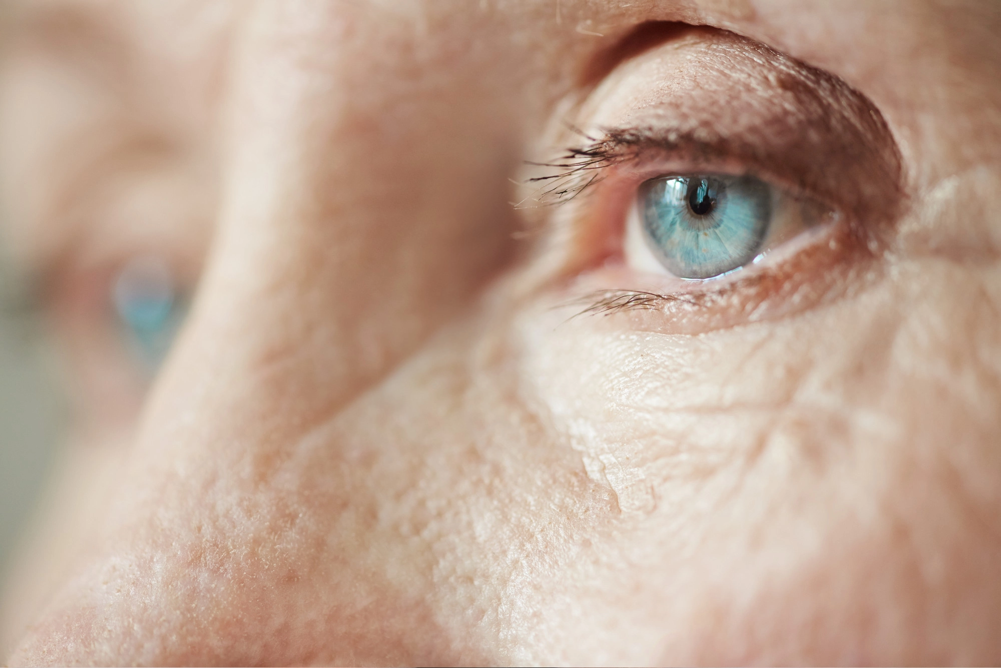Cataract Surgery
